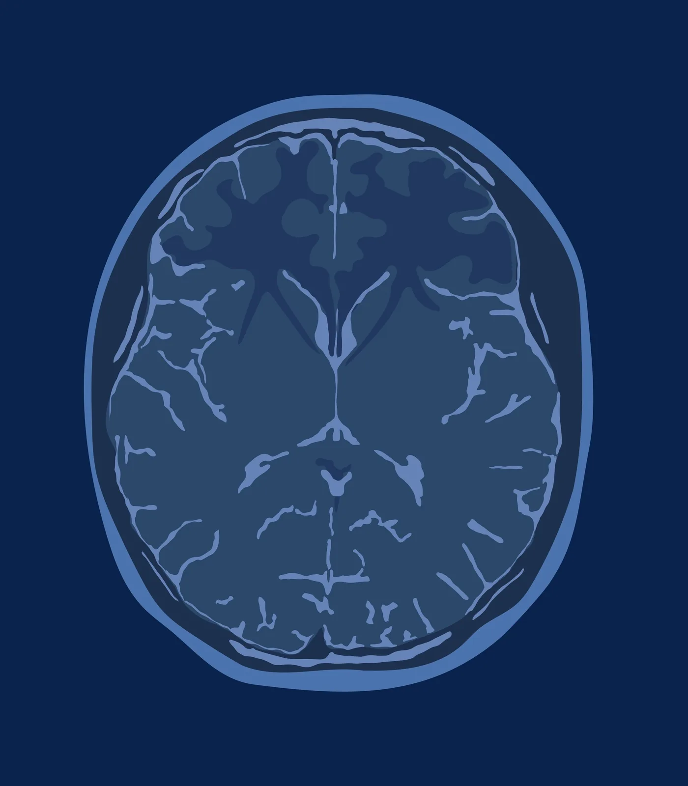 A brain seen from above, with its neural pathways crossing